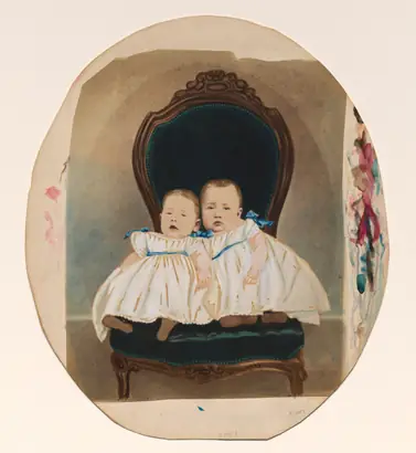 Dokumentasi museum Twin Babies. Davis Brothers (American).